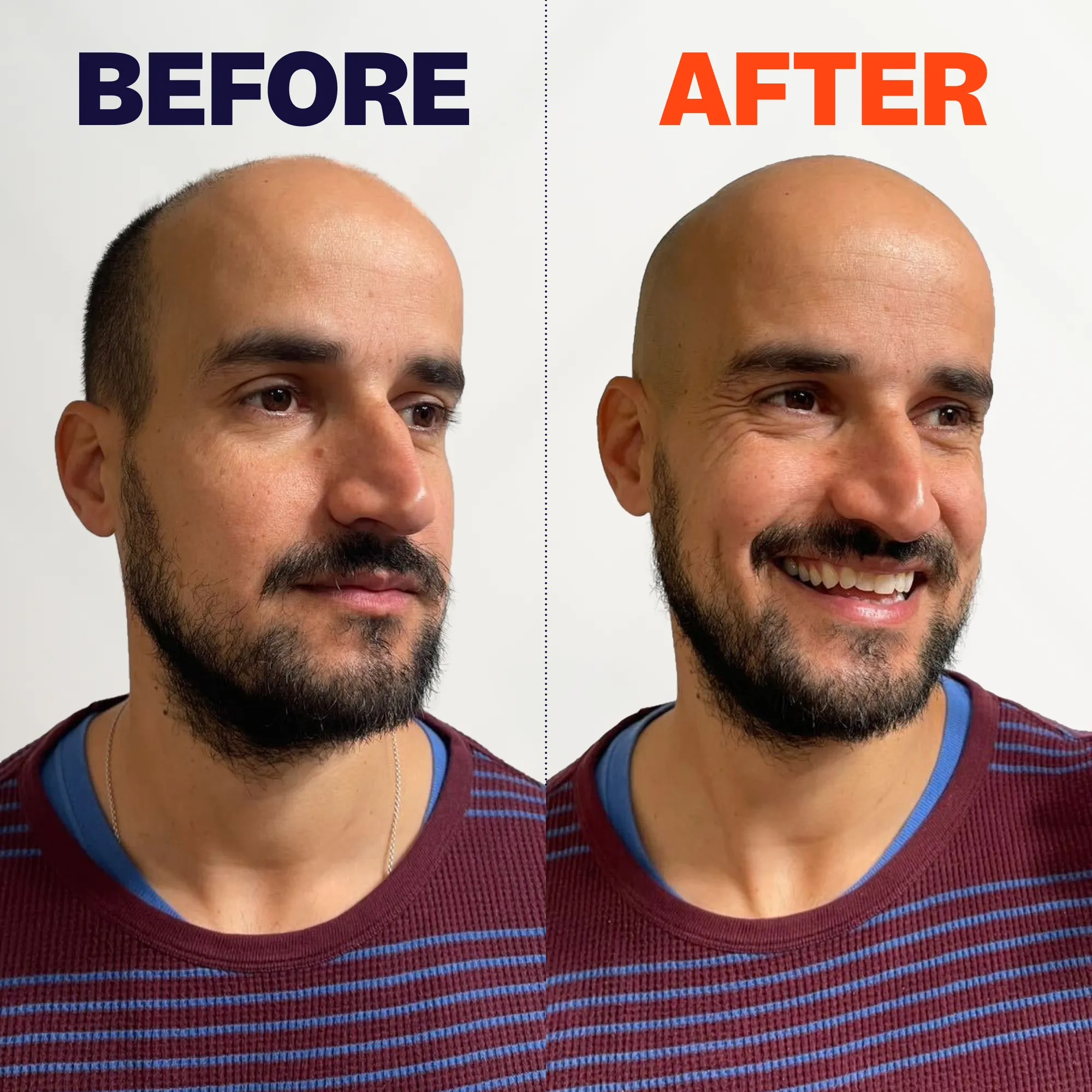 FlexSeries Shaving Kit