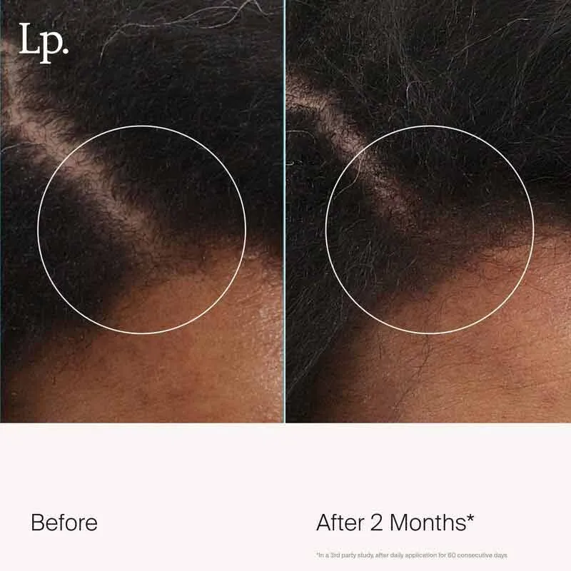 Living Proof Scalp Care Revitalizing Treatment